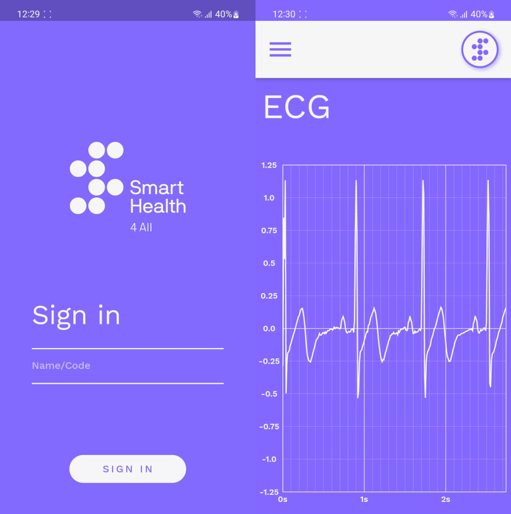 Biosensors